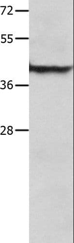 SERPINB5 / Maspin Antibody