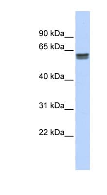 PEPD / PROLIDASE Antibody (aa359-408)