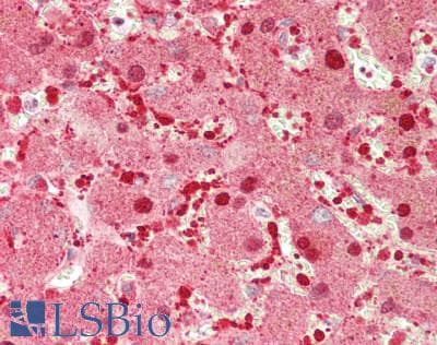 Polyclonal Rabbit anti-Human GP6 / GPVI Antibody (aa216-265, IHC, WB)