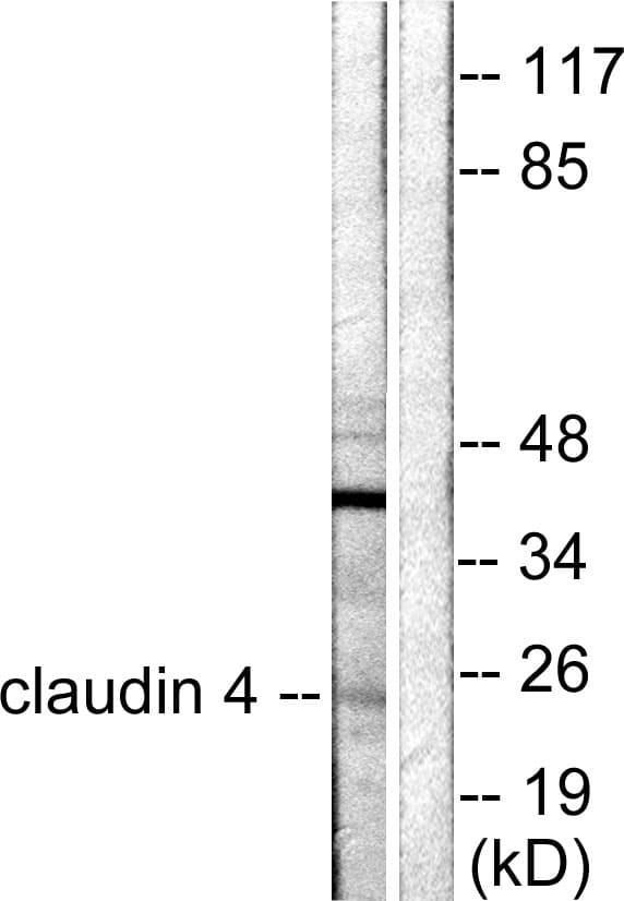 PathPlus™ CLDN4 / Claudin 4 Antibody (aa160-209)