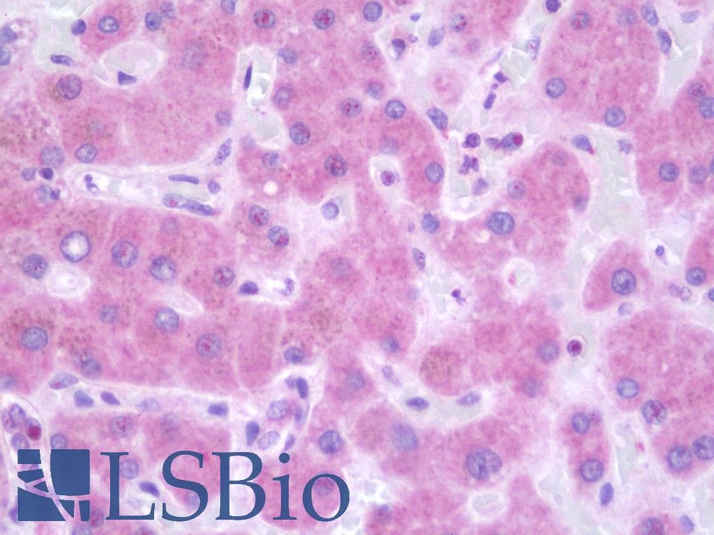ABCB1 / MDR1 / P Glycoprotein Antibody (aa347-710, clone 3B2, Carrier-free)