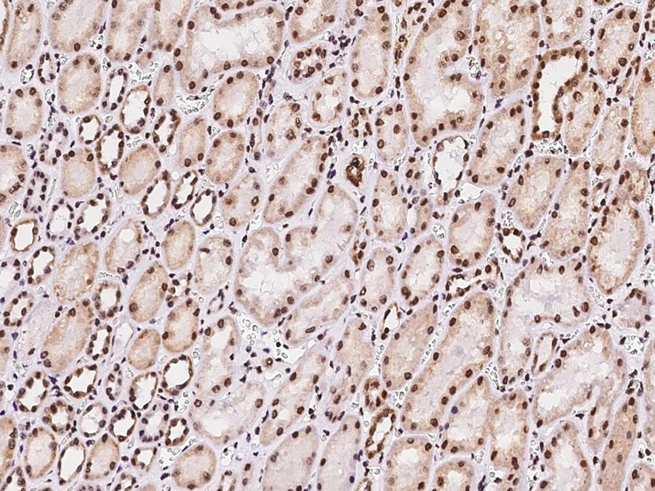 MBD5 Antibody (Preservative Free)