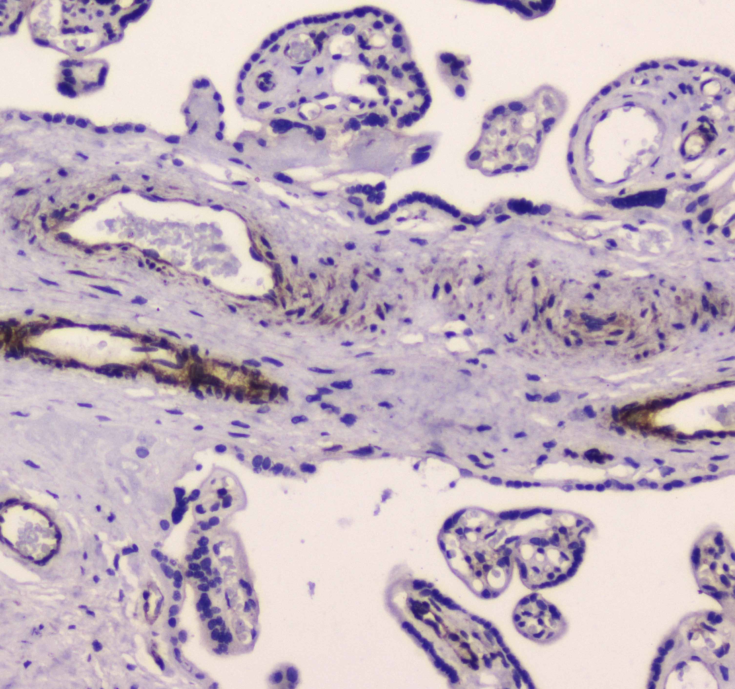 MYLK Antibody