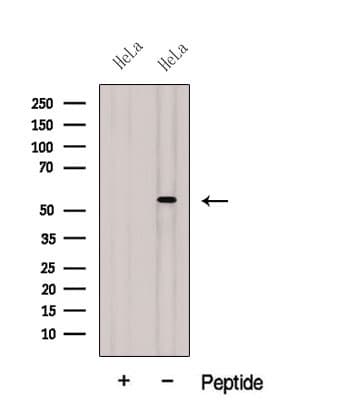 SH3P7 / HIP-55 Antibody