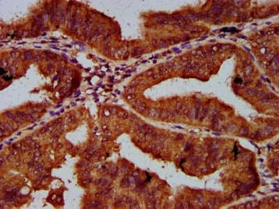 CUL7 Antibody