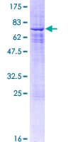 Human SIN3B Protein (Recombinant GST)