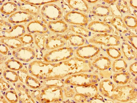 SLC9A1 / NHE1 Antibody