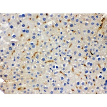 BMP5 Antibody (aa332-365)