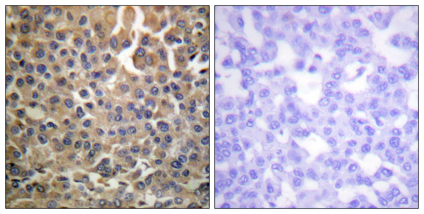 Polyclonal Rabbit anti-Human ERBB4 / HER4 Antibody (phospho-Tyr1284, IHC, IF, WB)