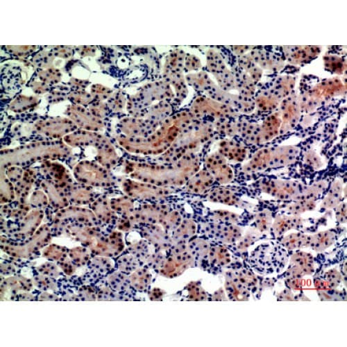 Polyclonal Rabbit anti-Human ENPEP / Aminopeptidase A Antibody (671-720 aa, Internal, IHC, WB)