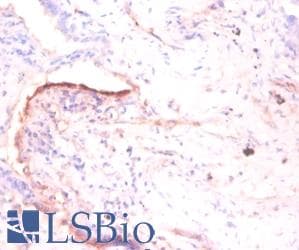 TNC / Tenascin C Antibody (Biotin)