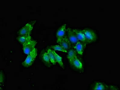 Complement C1QA Antibody
