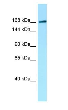 MAST1 Antibody (aa1334-1383)