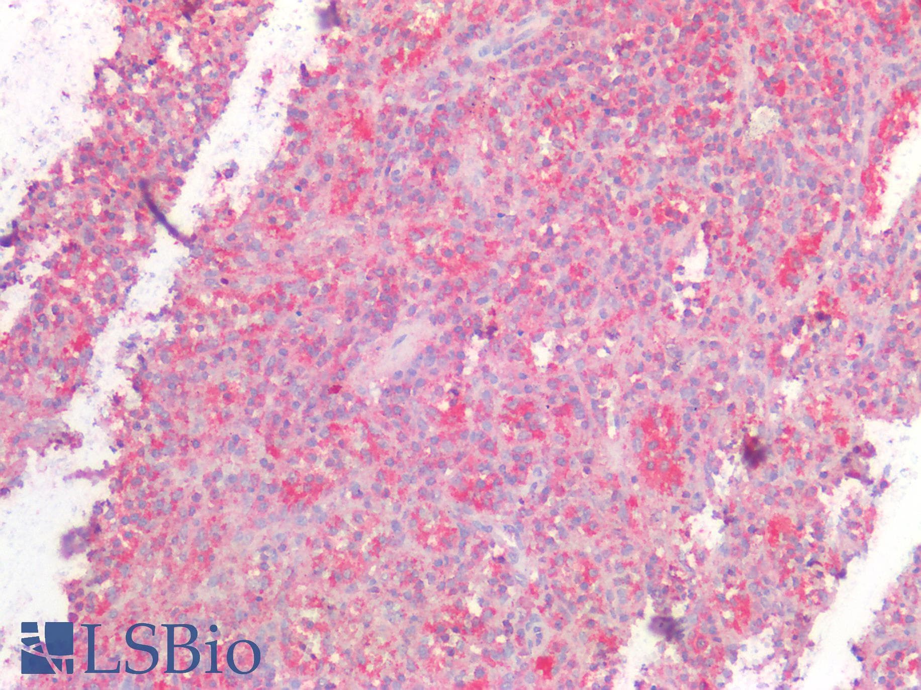 IHC-plus™ TP53 / p53 Antibody