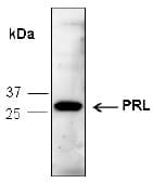 PRL / Prolactin Antibody (Preservative Free, Biotin)