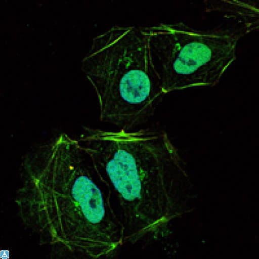 OPG / Osteoprotegerin Antibody