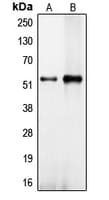 Translokin / CEP57 Antibody (Internal)