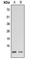 HMGN2 Antibody (N-Terminus)