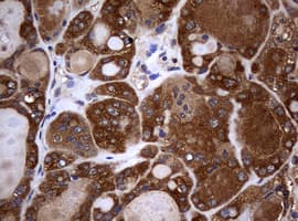 NME1 / NM23 Antibody (clone OTI7E5)