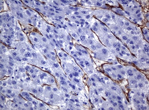PECAM-1 / CD31 Antibody (clone UMAB30)