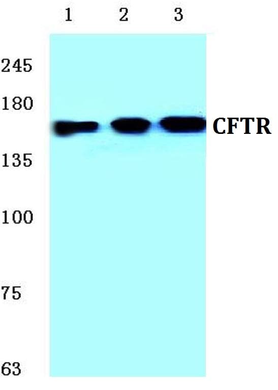 IHC-plus™ Polyclonal Rabbit anti-Human CFTR Antibody (Glu733, IHC, WB)