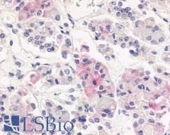 PathPlus™ Polyclonal Rabbit anti-Human AVPR1B Antibody (Cytoplasmic Domain, IHC)