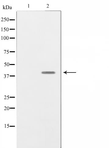NRG1 / Heregulin / Neuregulin Antibody