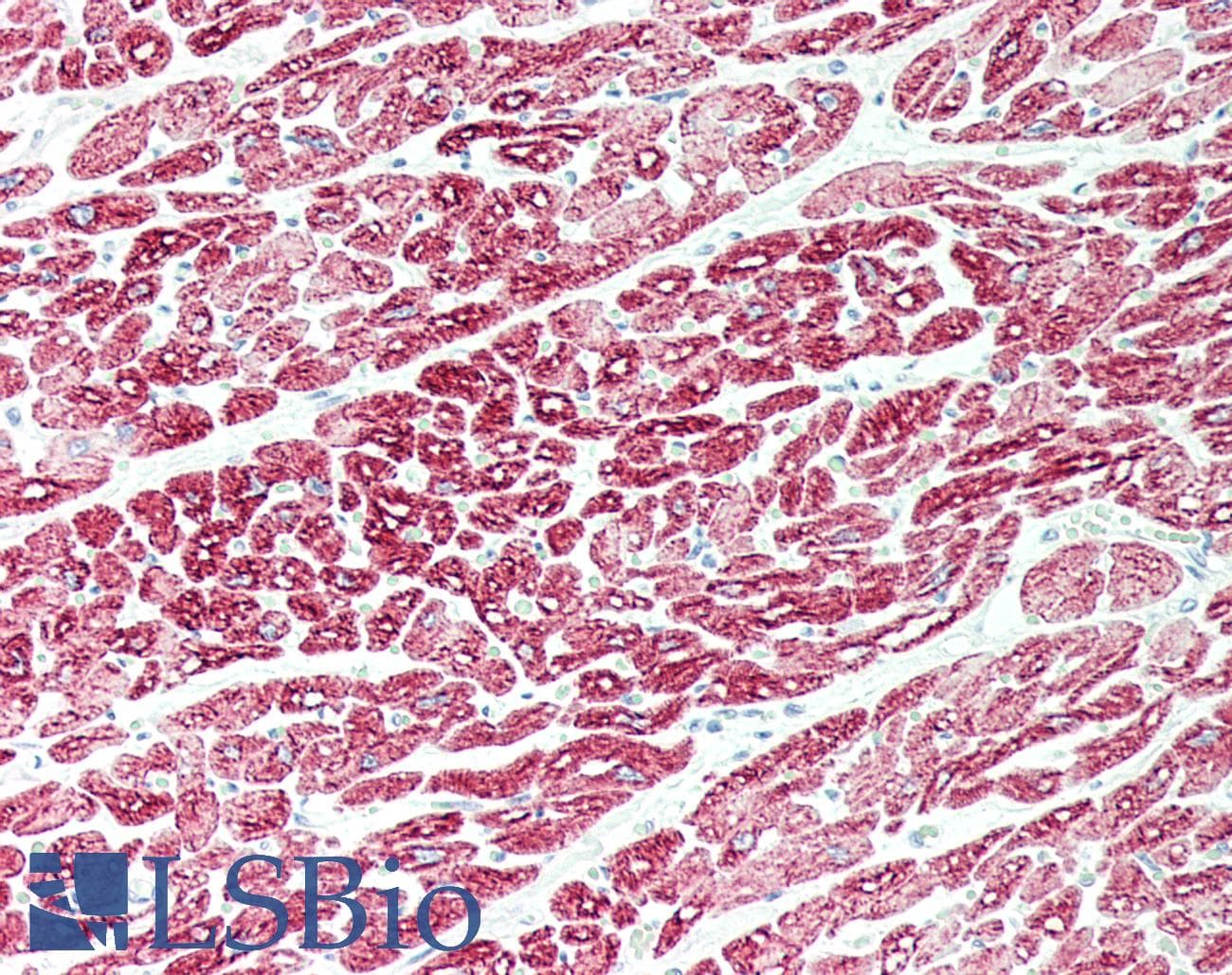 PathPlus™ DES / Desmin Antibody