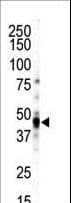 CAMK1D Antibody (aa302-333)