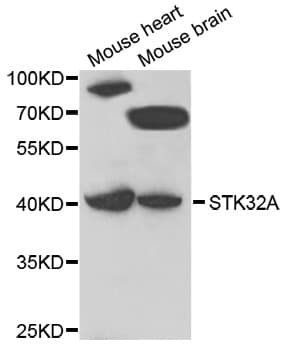 STK32A Antibody