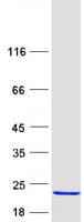 Human HR6B / UBE2B Protein (Recombinant Myc-DDK (Flag))