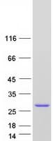 Human ROPN1B Protein (Recombinant Myc-DDK (Flag))