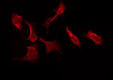 AKT1 Antibody (phospho-Ser124)