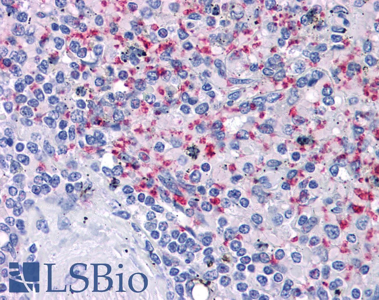 IHC-plus™ Monoclonal Mouse anti-Human ITGB3 / Integrin Beta 3 / CD61 Antibody (clone VI-PL2, IHC, WB)