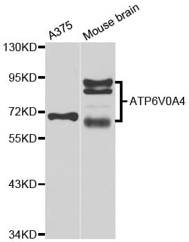 Polyclonal Rabbit anti-Human ATP6V0A4 Antibody (WB)