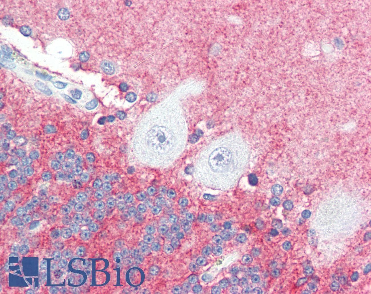 IHC-plus™ SLITRK2 Antibody