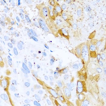 SPINT1 / HAI-1 Antibody