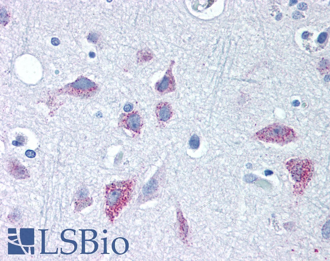IHC-plus™ WNT8B / Wnt 8b Antibody (Internal)