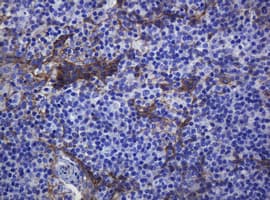 CDH1 / E Cadherin Antibody (clone OTI3E2)