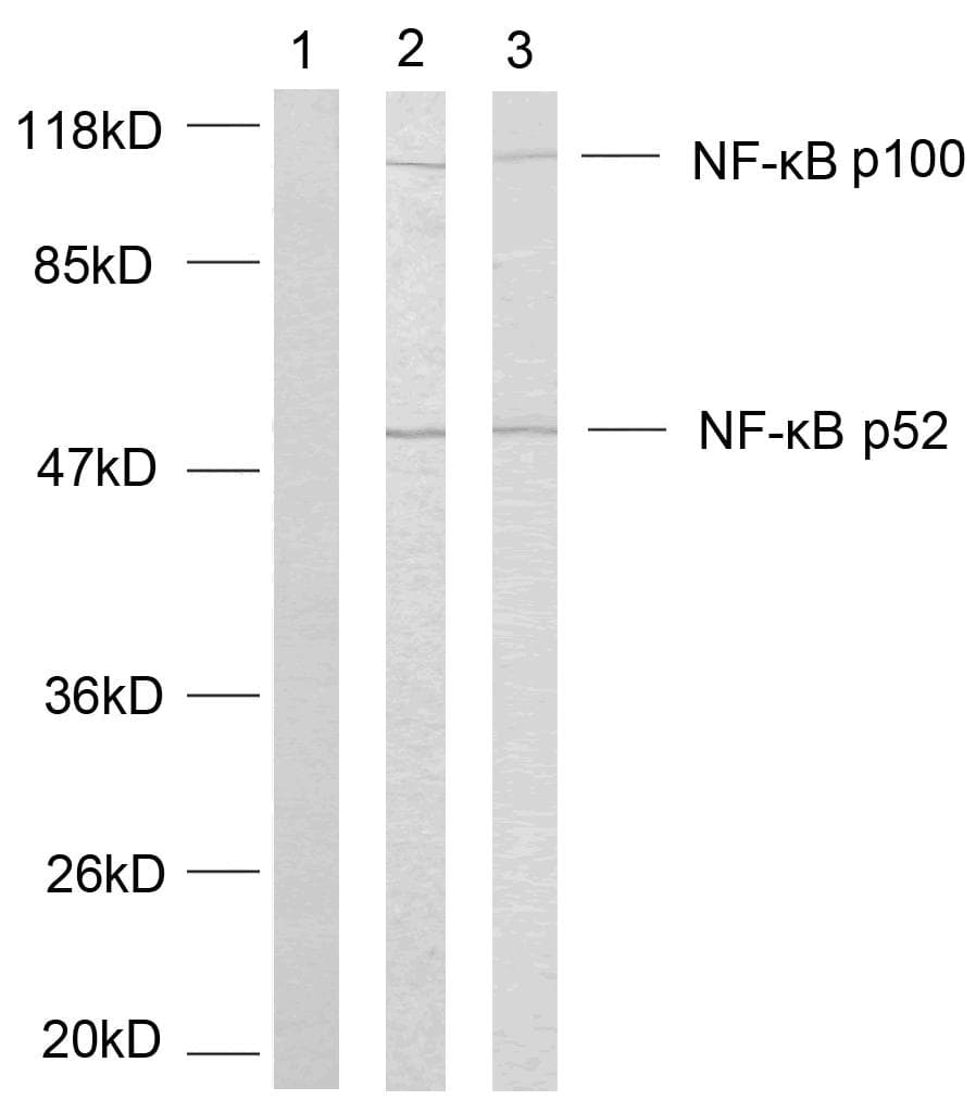 Polyclonal Rabbit anti-Human NFKB2 Antibody (p869, IHC, WB)