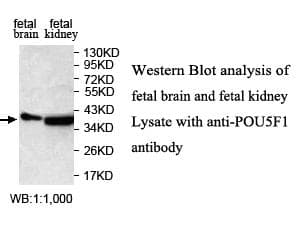 POU5F1 / OCT4 Antibody (aa64-288)