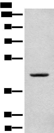 CANT1 Antibody