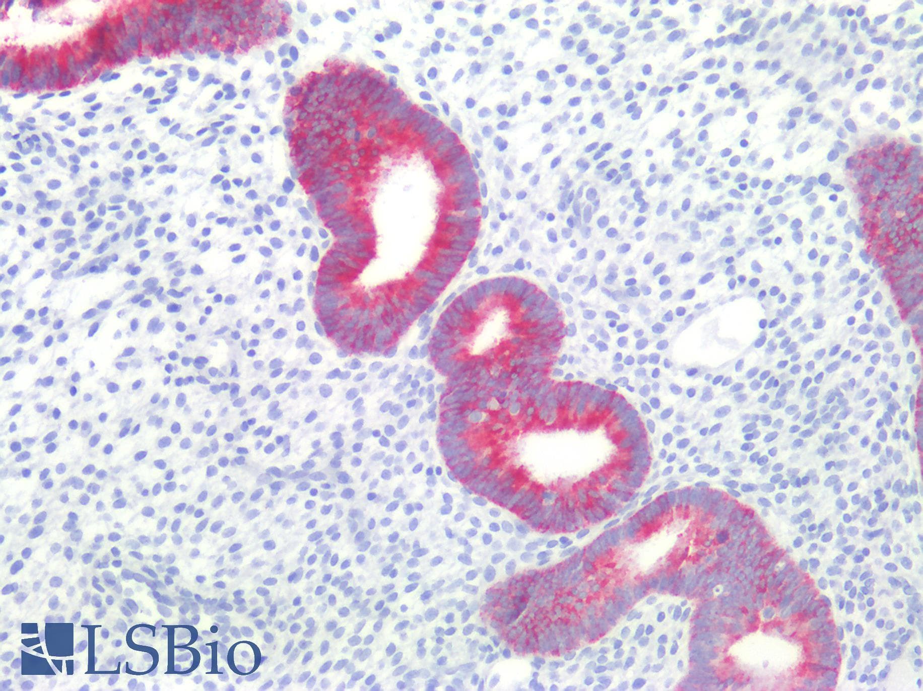 IHC-plus™ EMA / MUC1 Antibody (clone E29)