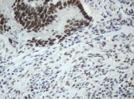 SF3A1 / SF3A120 Antibody (aa249-568, clone OTI3F4, Carrier-free)