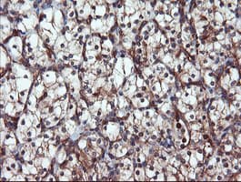 PSMA6 Antibody (clone OTI3B8)