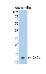 MIP2 / GRO2 / CXCL2 Antibody (aa34-107, PE)
