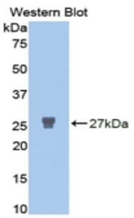 MMP2 Antibody (aa445-660, Cy3)