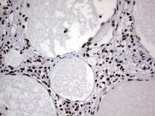 HNRNPL / hnRNP L Antibody (aa270-502, clone OTI2E4)