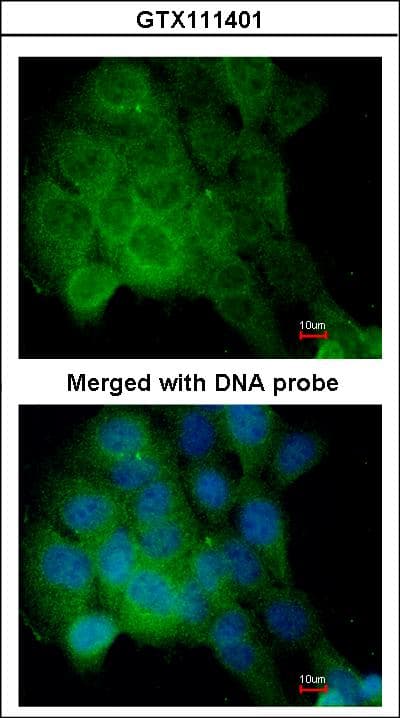 IHC-plus™ CAMK2D / CaMKII Delta Antibody (aa249-445)