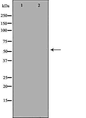 CDH13 / Cadherin 13 Antibody